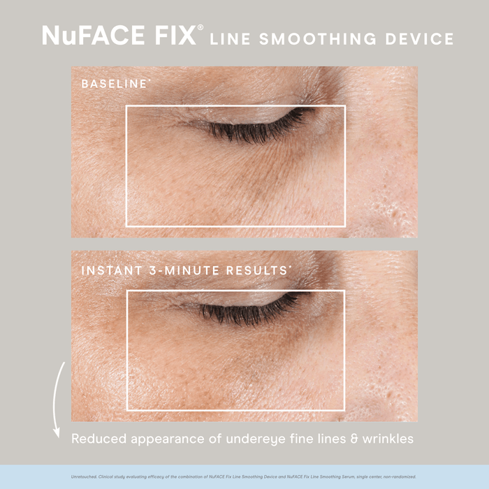 DISCONTINUED - NuFACE FIX® Starter Kit | NuFACE