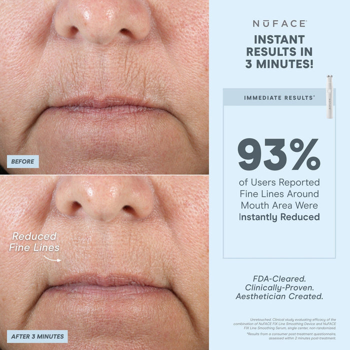 DISCONTINUED - NuFACE FIX® Starter Kit | NuFACE