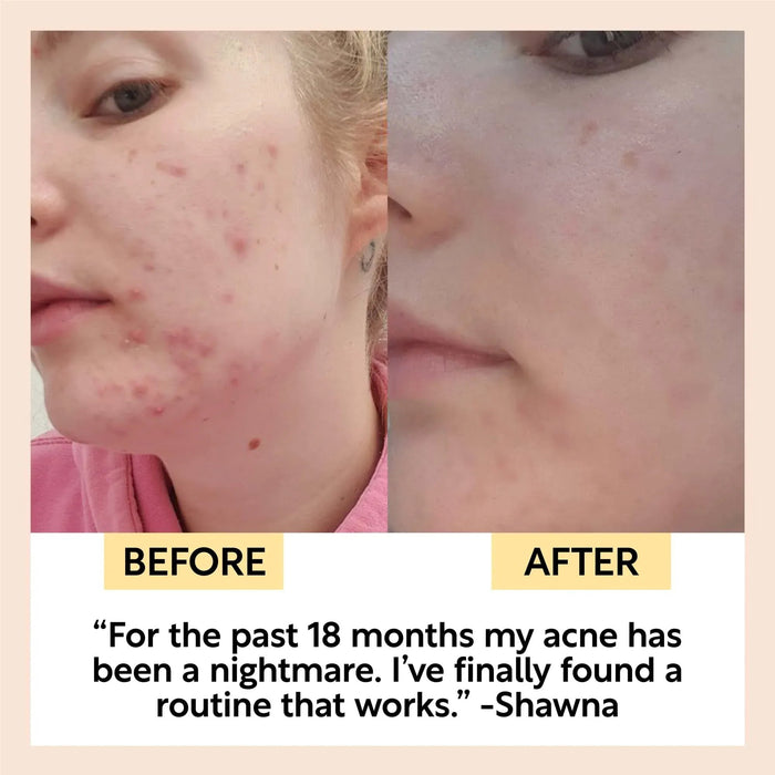 UpCircle Double Cleansing Duo