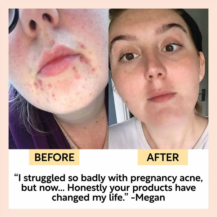 UpCircle Hydration Skincare Set