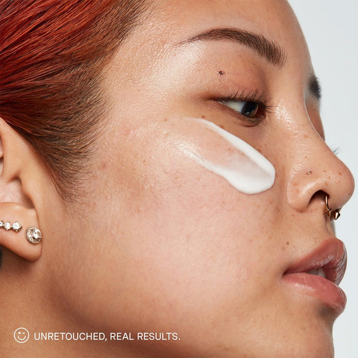 Kate Somerville Breakout Busters EradiKate Set - Beauty Tribe