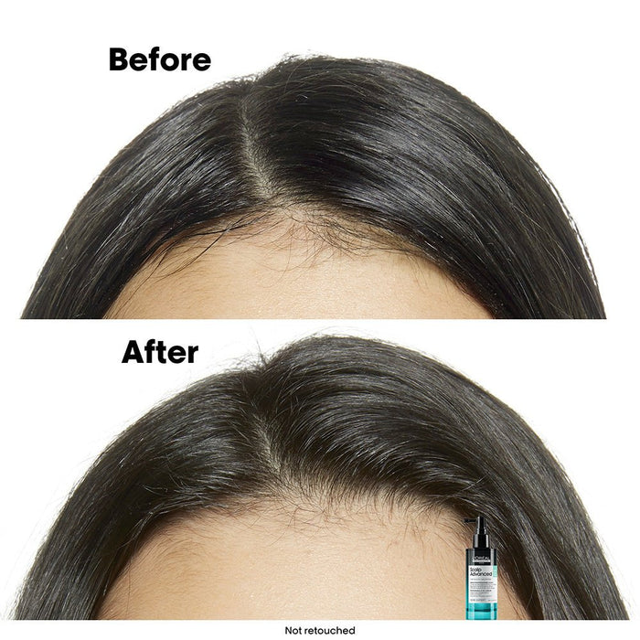 L'Oreal Professionnel Scalp Advanced Anti - Oiliness 5 in 1 professional leave - in serum 90ml - Beauty Tribe