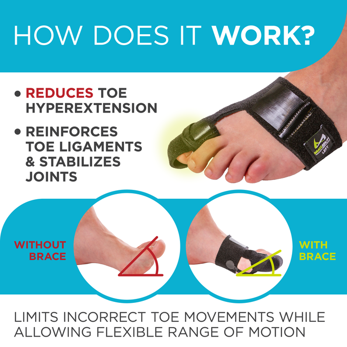 the turf to brace works to reduce toe extension and reinforce toe ligaments